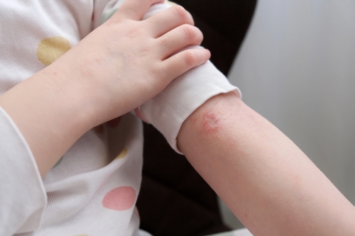 Children's skin care